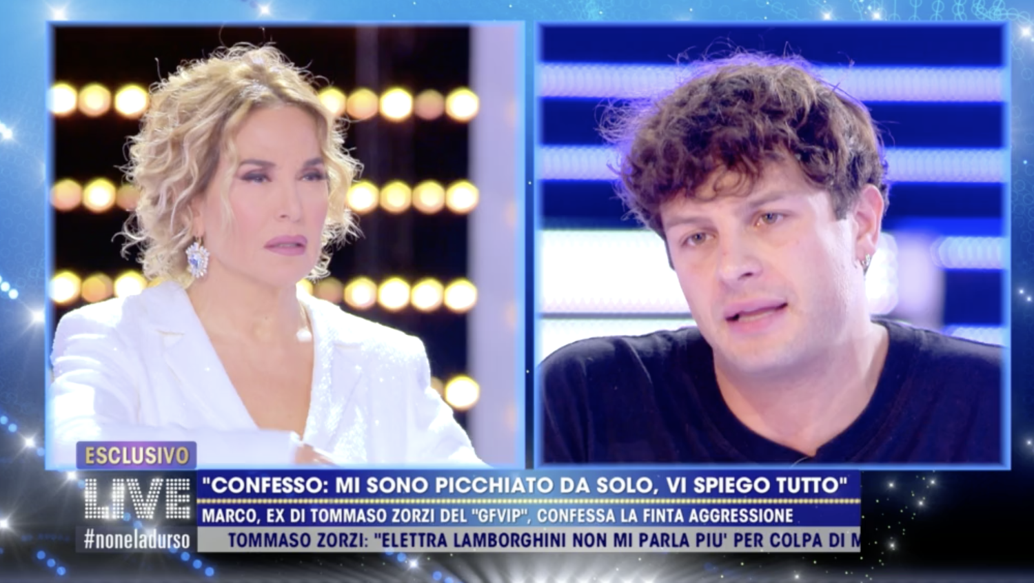 Live &#8211; Non è la d&#8217;Urso, le scuse di Iconize: &#8220;Ecco perché ho finto l&#8217;aggressione&#8221; (video)