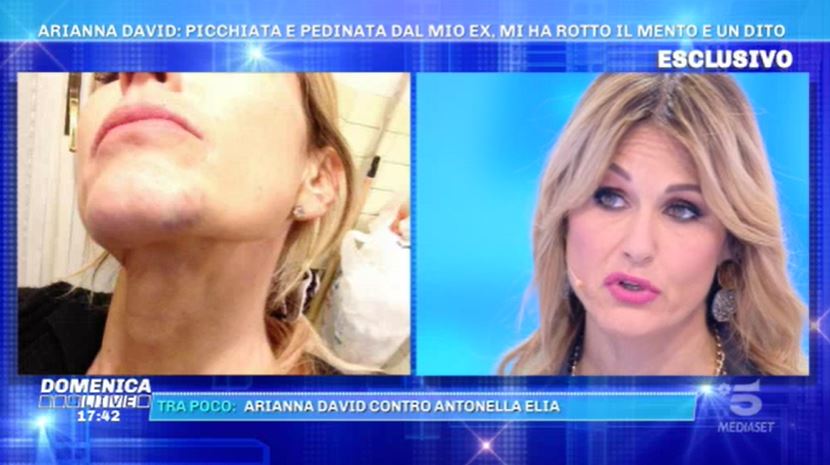 Arianna David a Domenica Live: “Un mio ex mi picchiava e pedinava. Nessuno mi ha aiutata, intorno a me”