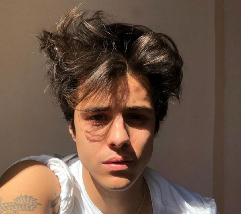 Michele Merlo