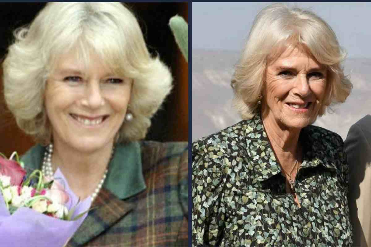 camilla prima dopo